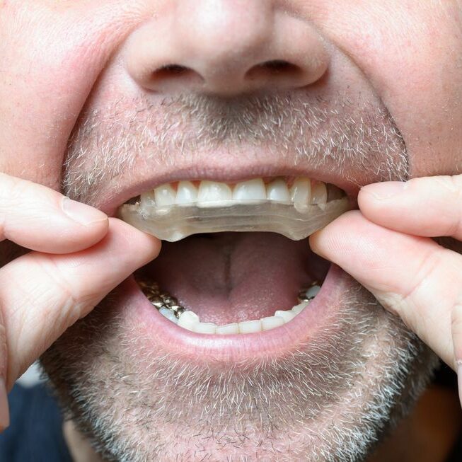 Symptoms Of Teeth Grinding